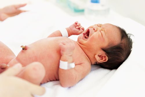  زنگ خطرهای مربوط به ناف و بند ناف نوزاد 