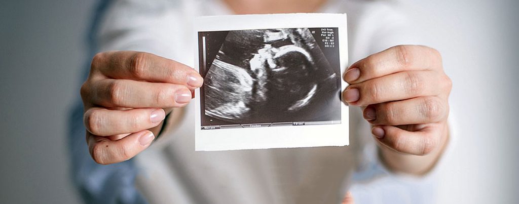 تغییرات جسمی مادر حامله در هفته هجدهم بارداری