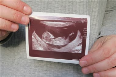عوارض شایع بارداری در هفته سیزدهم بارداری
